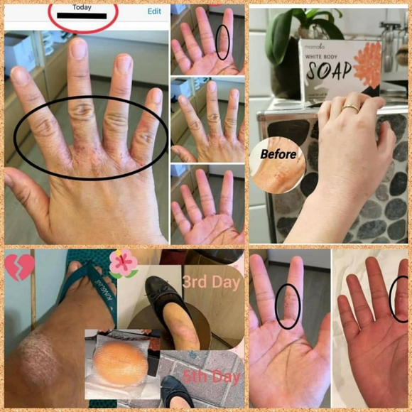 Mamala Soap - Picture 6 of 9